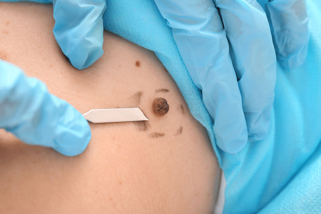 Dermatology