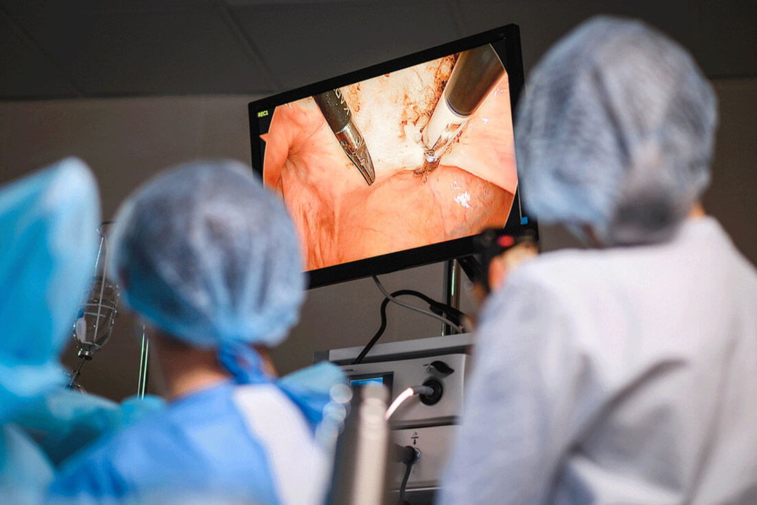 Endoscopy
